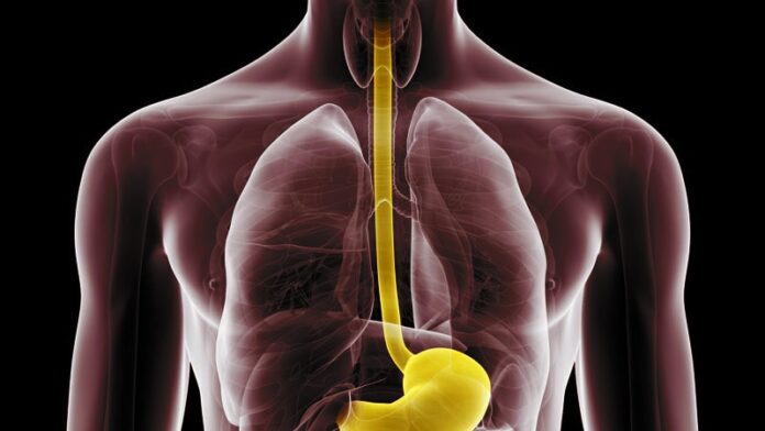 Dupilumab para la EEo: ¿cómo está mejorando el tratamiento?