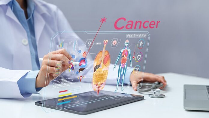 Los oncólogos expresan preocupaciones éticas sobre la IA en la atención del cáncer