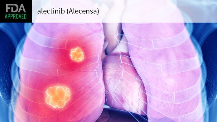 Alectinib obtiene la aprobación de la FDA para terapia adyuvante en NSCLC