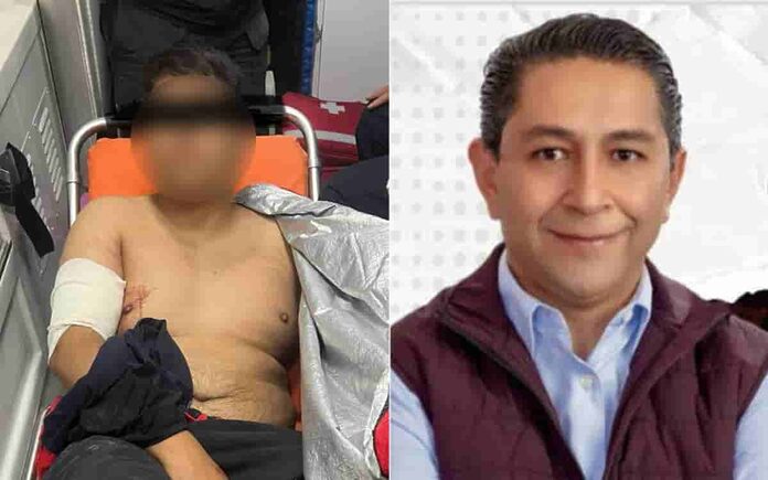 Balean a hijo de candidato a presidente municipal de Metepec, Edomex