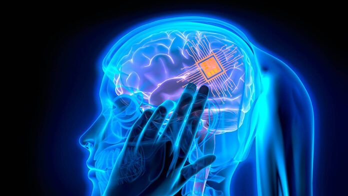 ¿Ha sido Elon Musk el primero en implantar un chip en un cerebro humano?