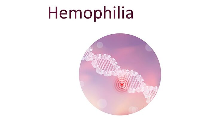 La EMA autoriza la terapia génica para la hemofilia B