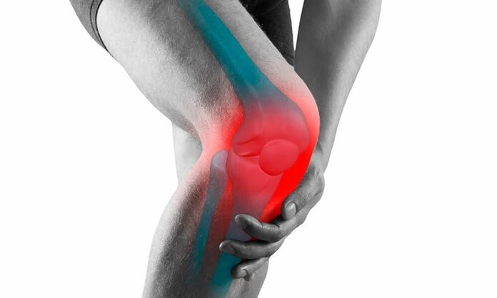 Artrosis de rodilla, principales causas, tratamientos y que puedes hacer para prevenir 