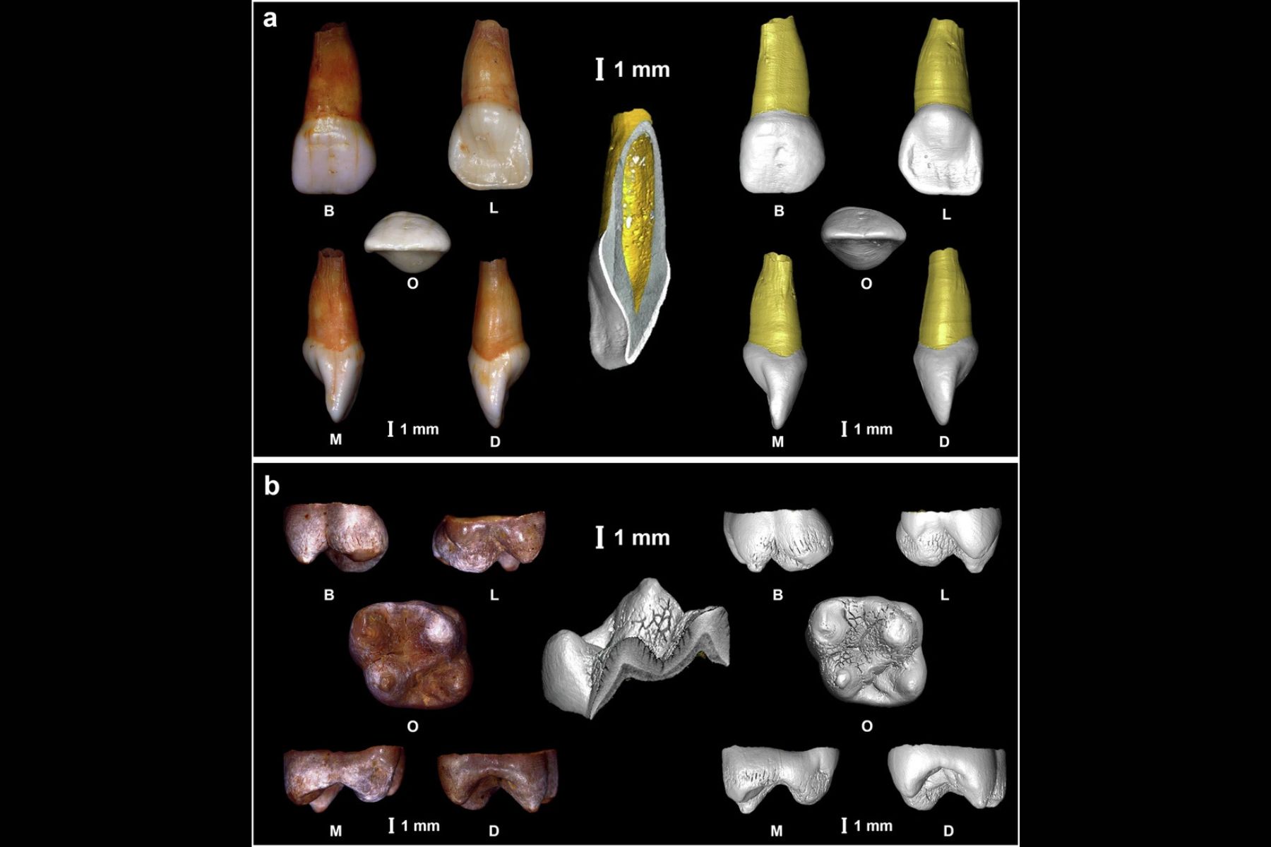 Piezas dentales